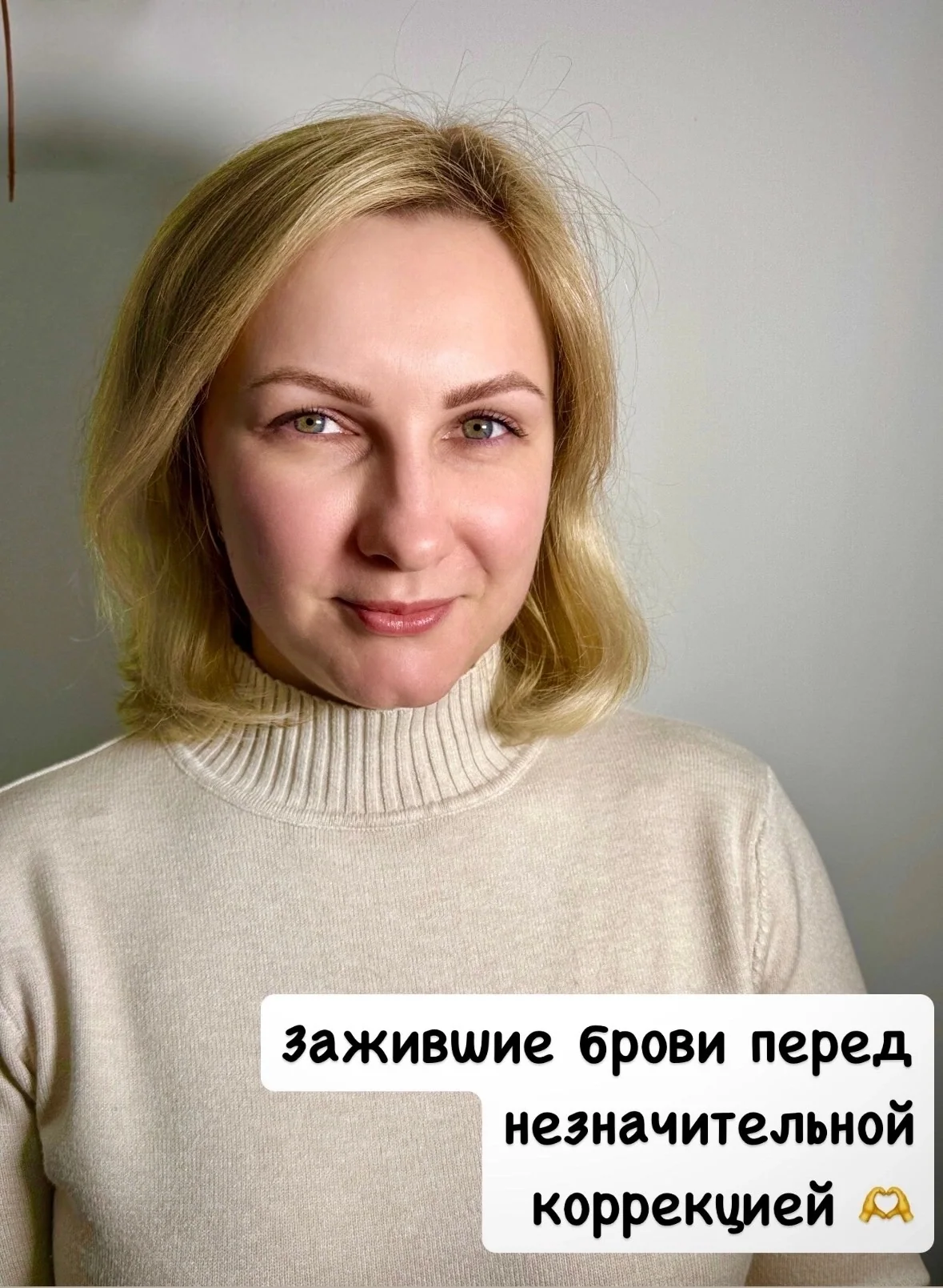 Зажившие брови